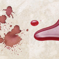 Просочення захисне Tenax Proseal 5 л водо масло брудовідштовхувальне для натурального і штучного каменю